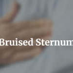 Bruised Sternum