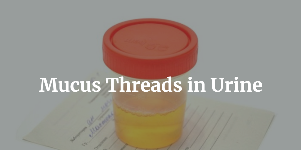 Mucus Threads in Urine