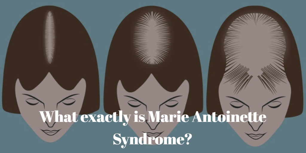 Marie Antoinette Syndrome
