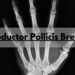 abductor pollicis brevis
