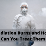 radiation burns