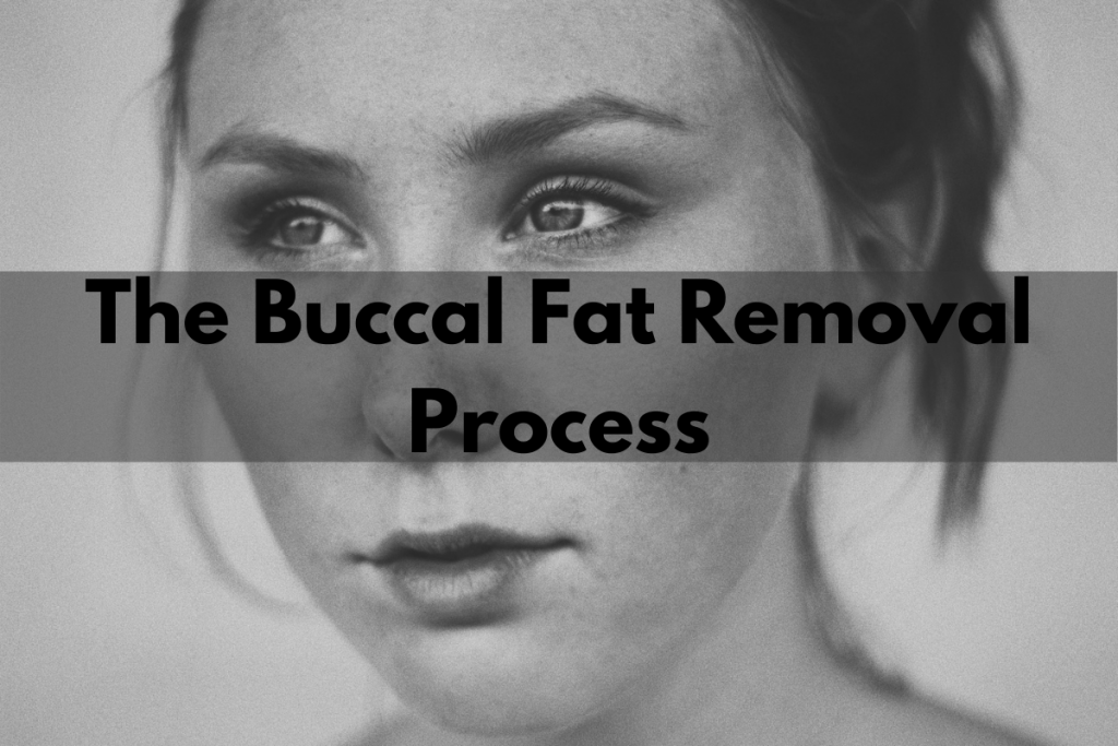 buccal fat removal