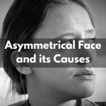 Asymmetrical Face