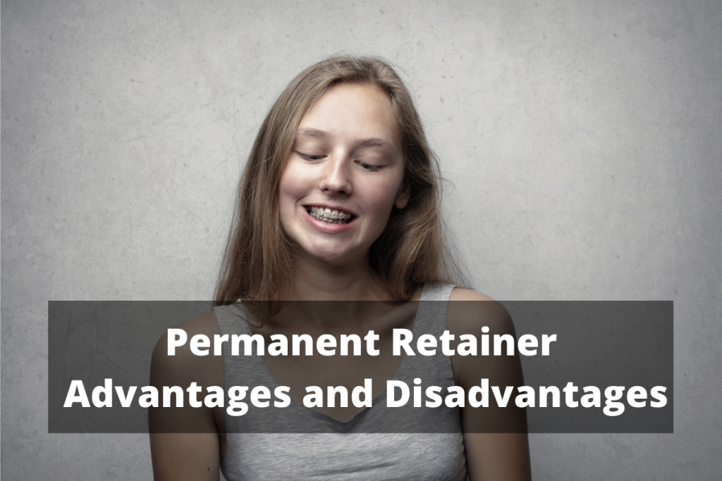 Permanent Retainer