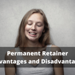 Permanent Retainer