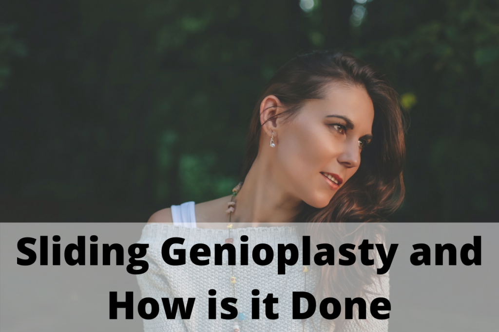 Sliding Genioplasty