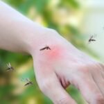 Mosquito vs Flea Bites