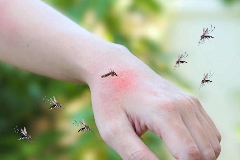 Mosquito vs Flea Bites