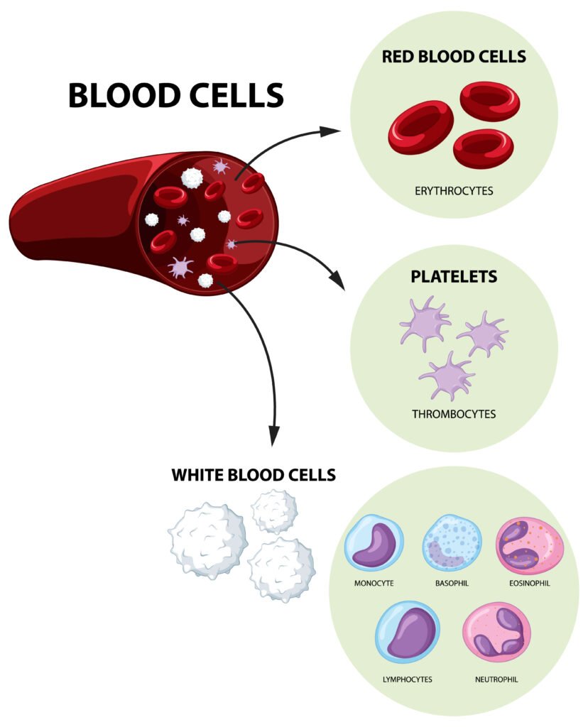 Understanding the Link Between Myelodysplastic Syndrome and Railroads