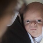 Hutchinson-Gilford Progeria Syndrome