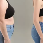 Semaglutide for Weight Loss